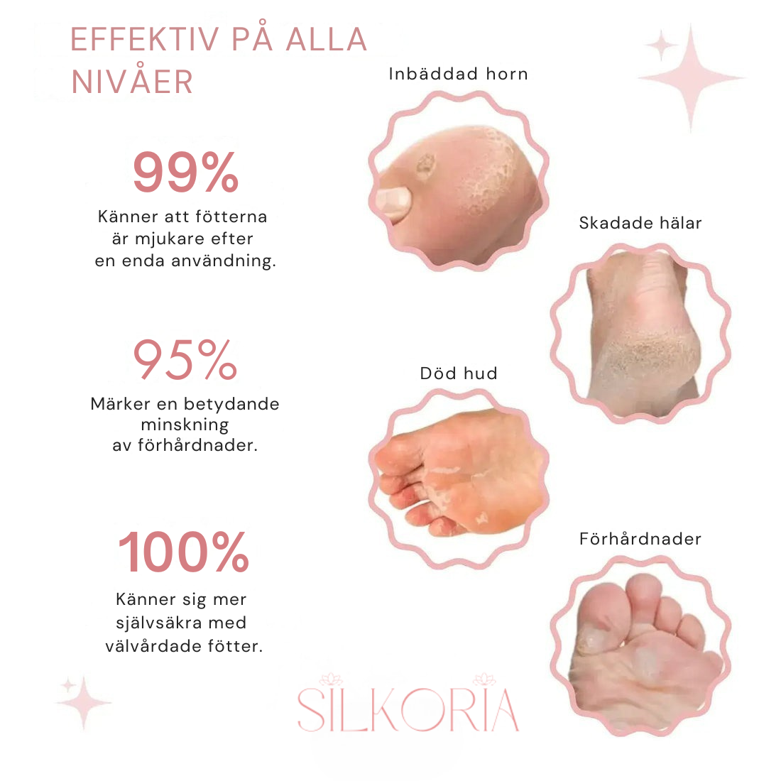 ✨ SilkyFeet™ – Elektrisk Fotfil för lena och fina fötter