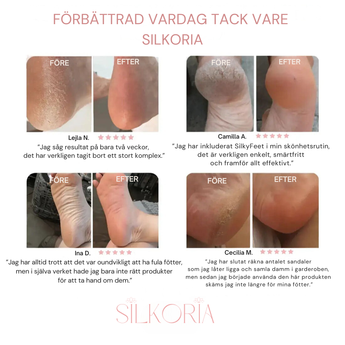 ✨ SilkyFeet™ – Elektrisk Fotfil för lena och fina fötter
